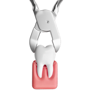 Tooth Extractinator Best Dental Clinic KL | 24 Hours Dental Clinic KL