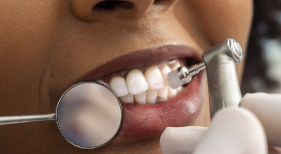 Close up view of a dentist polishing a patient's teeth using a dental drill and mirror, highlighting precision in oral health care